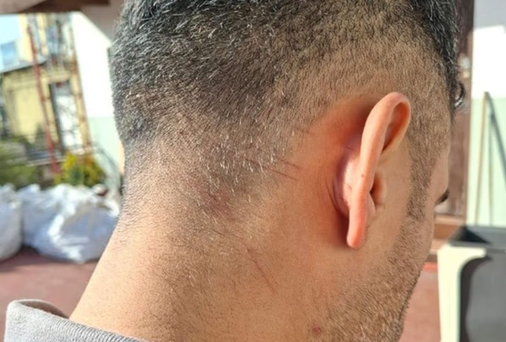 Las marcas en el cuello y la nuca de Navarro las habría provocado Milagros al defenderse.