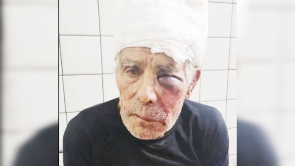 Oscar “El Paisano” Orono, un veterano ciclista de 80 años, falleció tras haber sufrido un violento robo y caer desde un espacio alto en su casa.&nbsp;