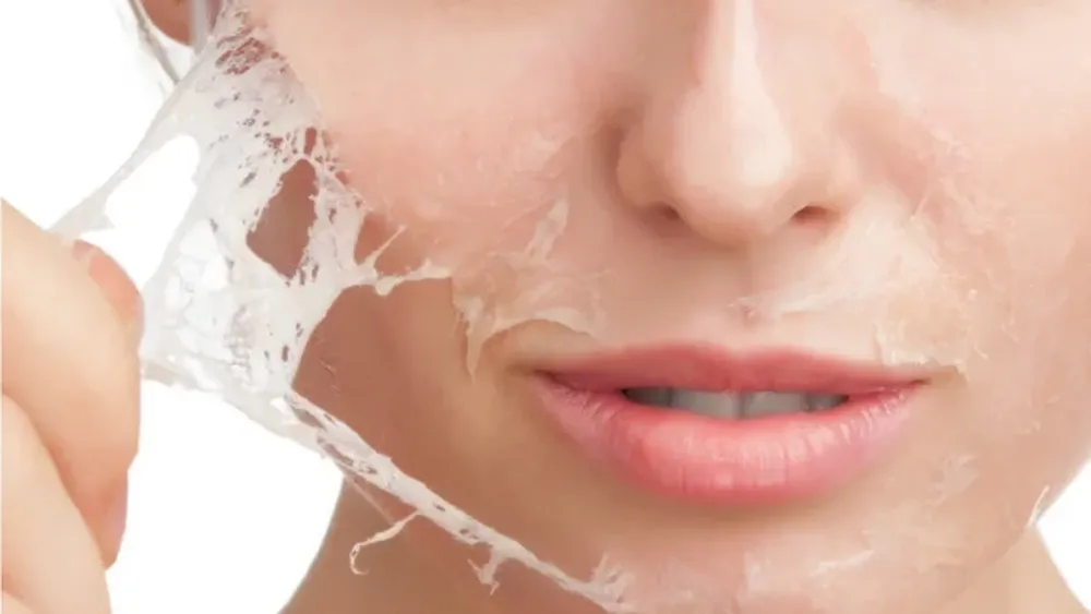 Hasta el momento solo logran tratarse los síntomas de la enfermedad, mayoritariamente controlando el dolor y la picazón y curando las heridas causadas por la fragilidad cutánea.