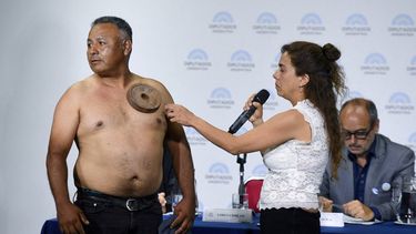 Las supuestas pruebas de a magnetización de un hombre.