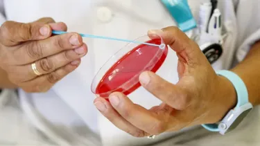 En Argentina, la Región Sur es donde más casos de sífilis se registraron en 2025.