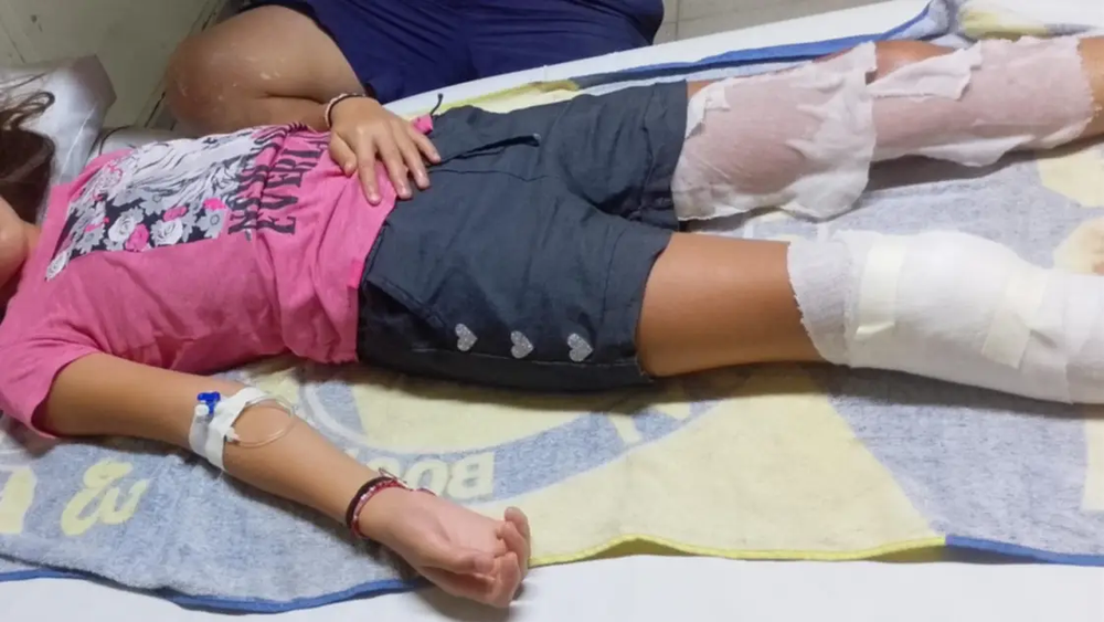 Dos niños resultaron heridos en Bahía Blanca por una explosión.
