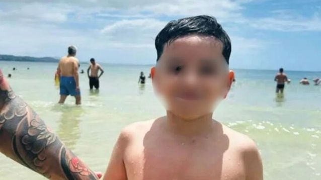 Bastian, de 8 años, tiene múltiples fracturas de cráneo.