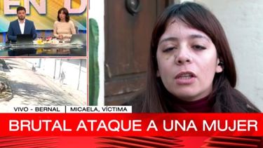 Micaela fue atacada a piedrazos por dos personas en situación de calle: terminó con el tabique de la nariz roto. (Imagen de TV)