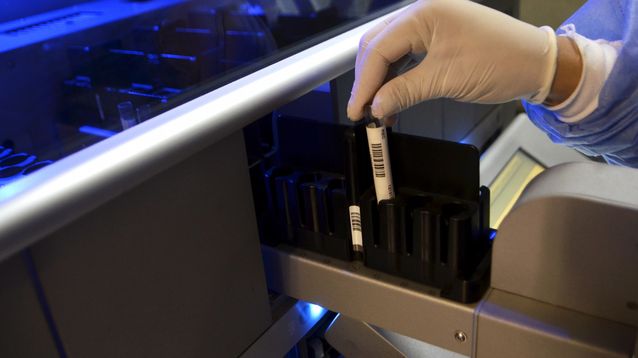 Detectan seis casos de un rarísimo grupo sanguíneo: qué es el síndrome de Gerbich