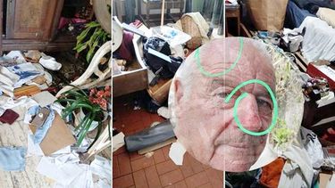 El hombre de 79 años fue atacado en su casa de Los Hornos.&nbsp;