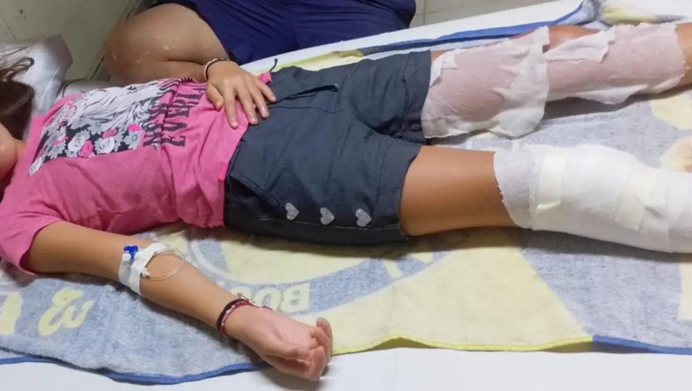 Dos niños resultaron heridos en Bahía Blanca por una explosión.