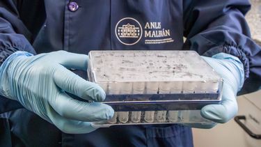 A través de ANLIS Malbrán, nuestro país envía material para hacer 2.500 pruebas a países que pueden tener casos de hantavirus.
