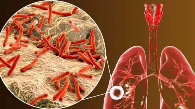 El bacilo causante de la tuberculosis.