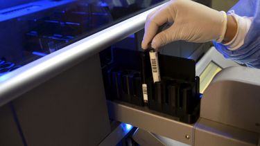 detectan seis casos de un rarisimo grupo sanguineo: que es el sindrome de gerbich