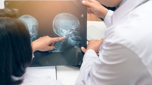 La mayoría de los tumores de cabeza y cuello se diagnostican en estadios avanzados.