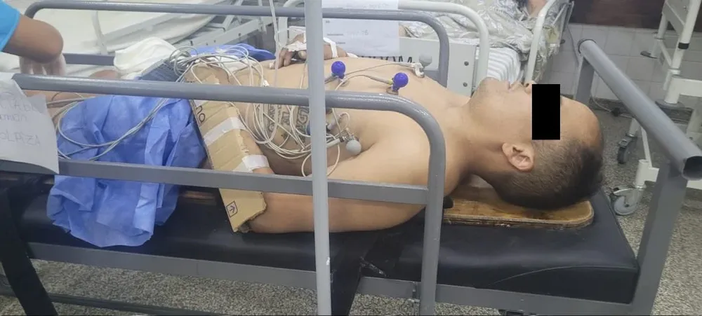 Delincuente atacado en Mar del Plata.