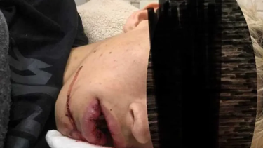 El joven fue hispitalizado tras la golpiza que recibió en la llamada QuintoFest. (Gentileza Luján Hoy)