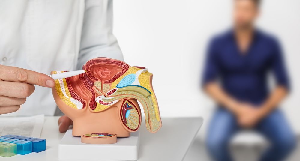 Aprueban en el país una nueva terapia para el cáncer de próstata avanzado.