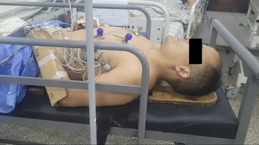Delincuente atacado en Mar del Plata.