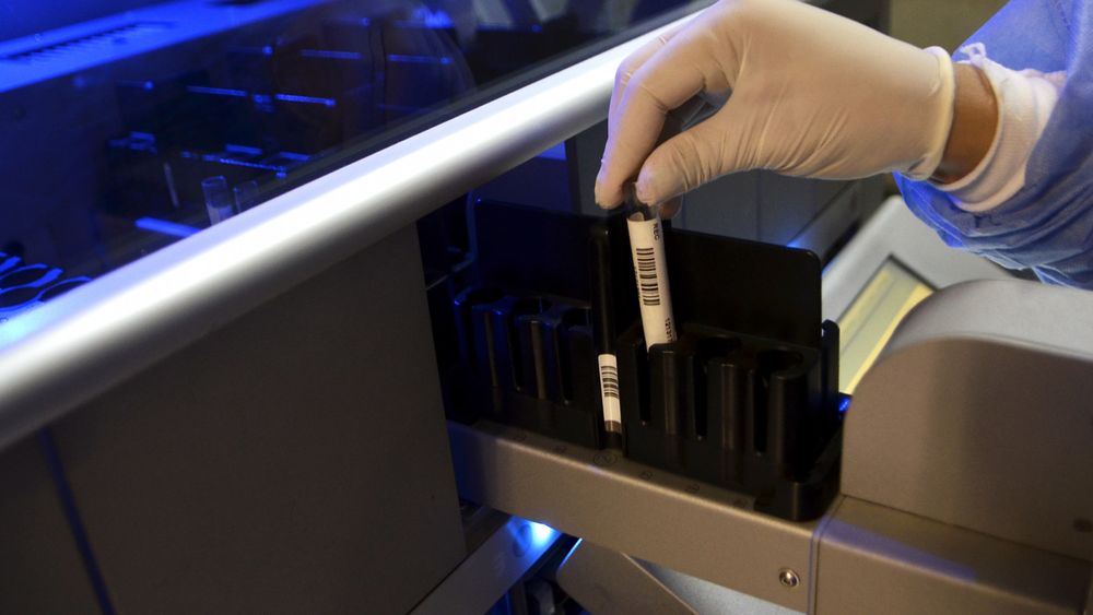 Detectan seis casos de un rarísimo grupo sanguíneo: qué es el síndrome de Gerbich