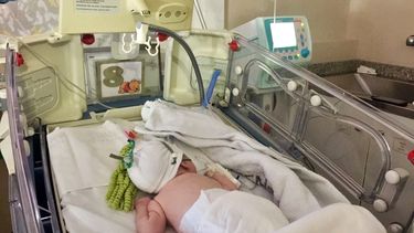 El VSR es la principal causa de infecciones respiratorias bajas en lactantes.&nbsp;