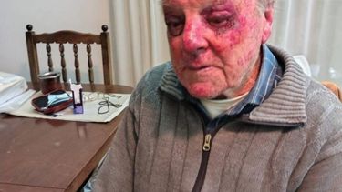 El hombre de 90 años atacado en Miramar.