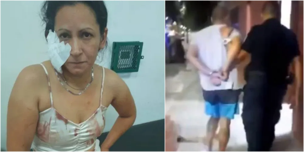 La víctima con visible asistencia médica en su oreja (izq) y el agresor en horas de su detención (der) Foto Entremediosweb