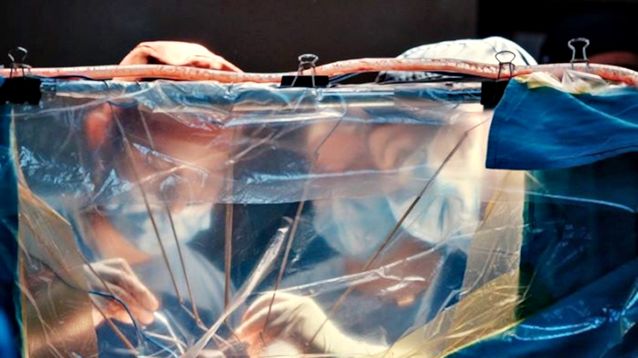 Realizan una cirugía cerebral con paciente despierta y monitoreo de funciones simultáneo
