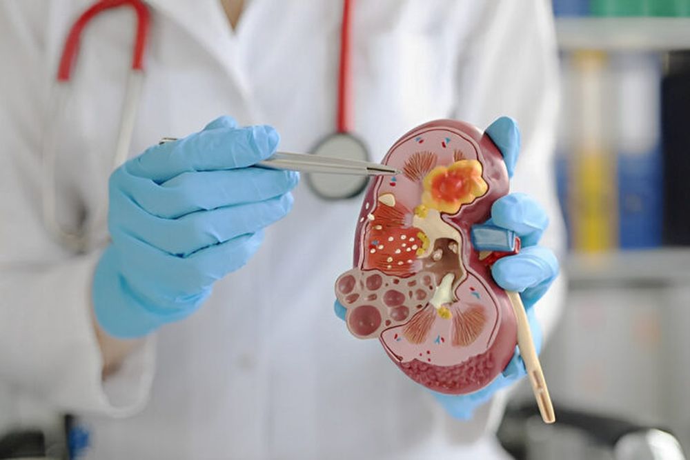 Cada 13 de marzo se conmemora el Día Mundial del Riñón.
