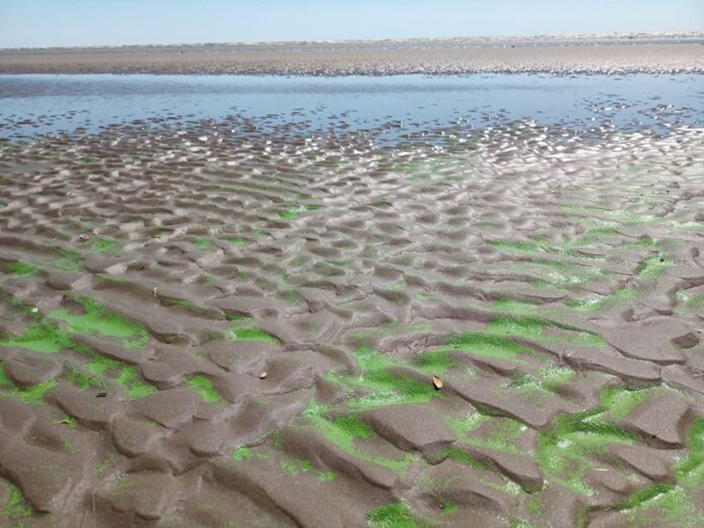 Las cianobacterias producen afecciones en piel, mucosas y sistema gastrointestinal.