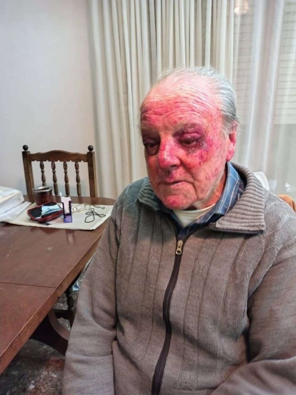 El hombre de 90 años atacado en Miramar.