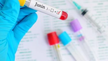 El Virus Junín produce la Fiebre Hemorrágica Argentina, y se transmite a través de roedores infectados.