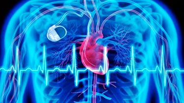 ciencia y salud: el hospital rossi de la plata participa del desarrollo de un revolucionario marcapasos