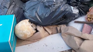 salio a dejar basura en un container y encontro un craneo humano