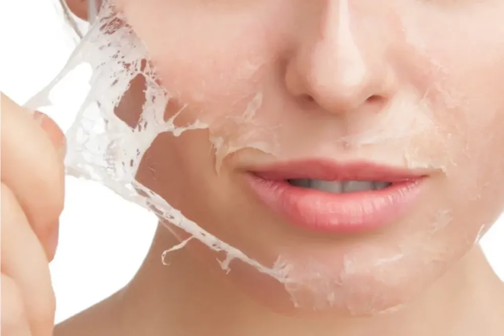 Hasta el momento solo logran tratarse los síntomas de la enfermedad, mayoritariamente controlando el dolor y la picazón y curando las heridas causadas por la fragilidad cutánea.