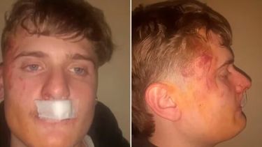 El joven agredido en Zárate.