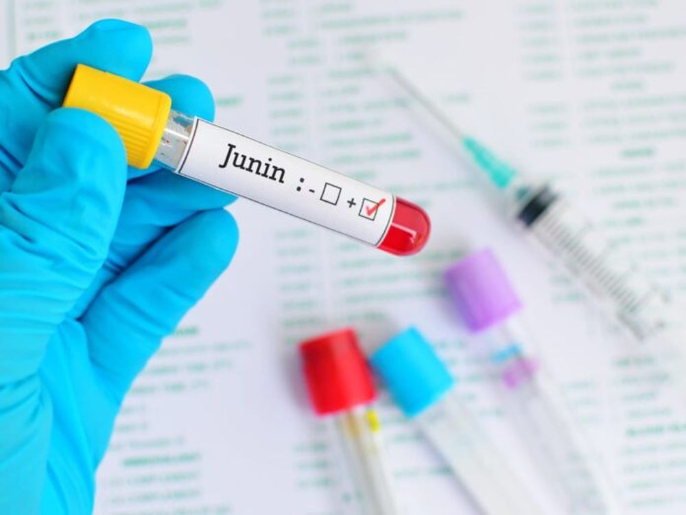 El Virus Junín produce la Fiebre Hemorrágica Argentina, y se transmite a través de roedores infectados.