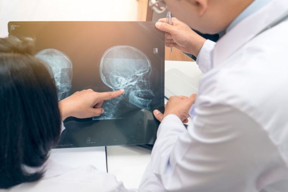 La mayoría de los tumores de cabeza y cuello se diagnostican en estadios avanzados.