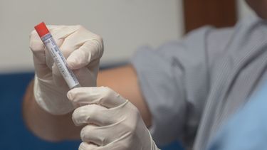 Las muestras de ADN son el material físico que contienen la información genética de un individuo.