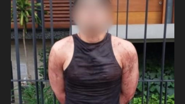 Uno de los muchachos que se peló a cuchilladas con otro, en medio de la escena del crimen de dos mujeres de la familia.