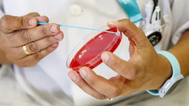 En Argentina, la Región Sur es donde más casos de sífilis se registraron en 2025.