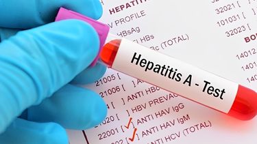 hepatitis a: se confirmaron 32 casos nuevos y el pais entro en zona de alerta sanitaria