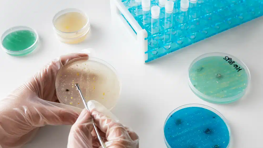 Cultivo bacteriano en laboratorio.&nbsp;