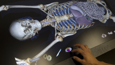 Diarios Bonaerenses | La virtopsia es una técnica que comprende una serie de procedimientos que utilizan la tecnología proveniente de las tomografías computadas multicorte y la resonancia magnética.